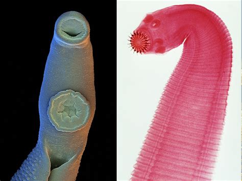  Xenotrema:  Een Parasitaire Platworm Die Met Zelfvertrouwen De Baarmoeder Van Zalm Bevloeit!